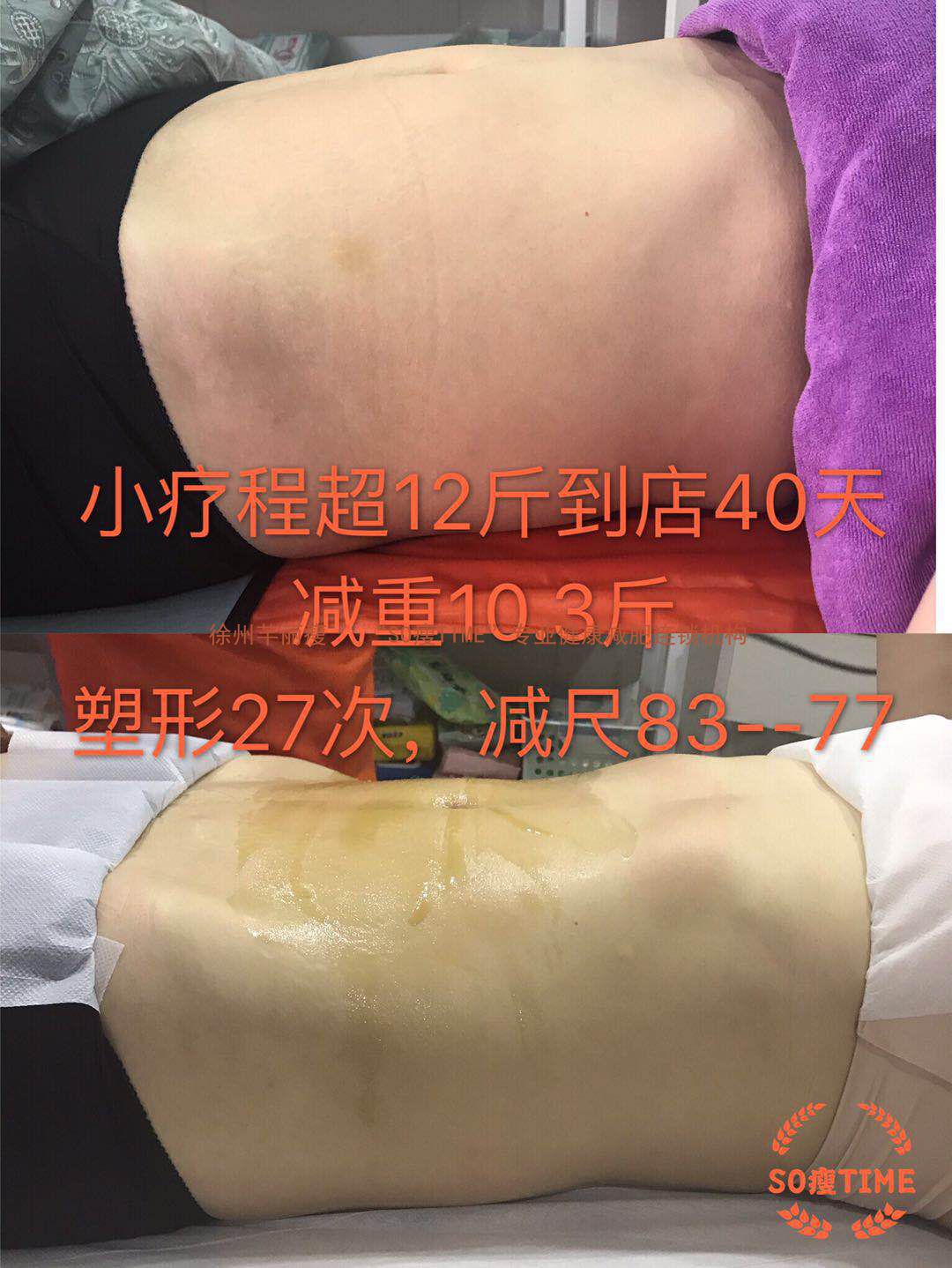 减肥，会对女性月经造成影响吗？