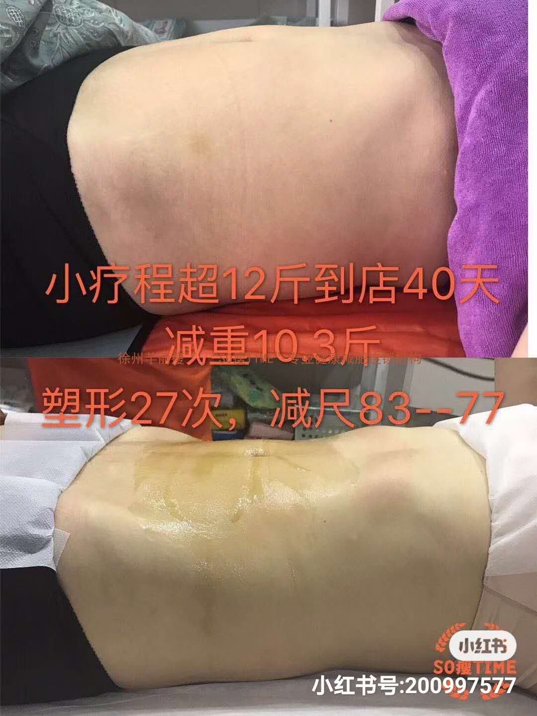 女性如何消除凸出的腹部？男性，如何消除大肚腩？